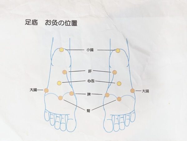 足底のお灸